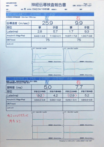 神経伝導検査結果